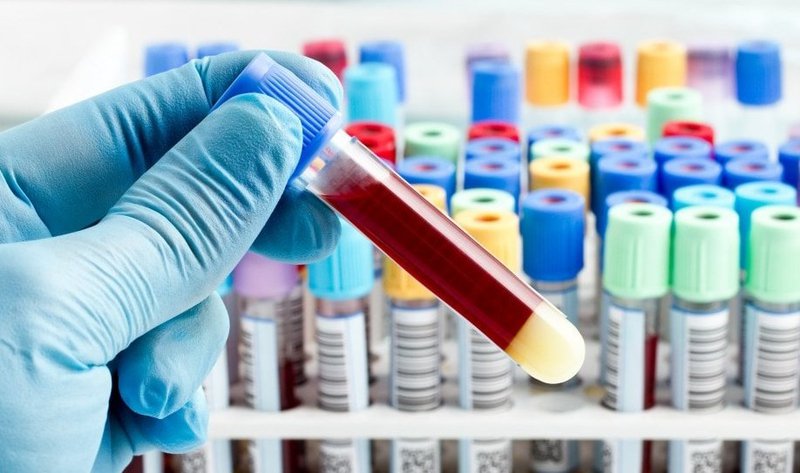 Báo giá xét nghiệm ADN tại Vinh Nghệ An